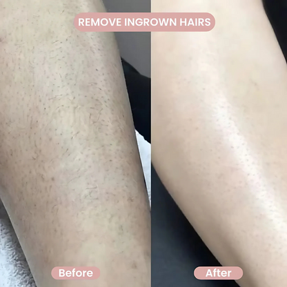 All-in-One Women’s Body Shaver™