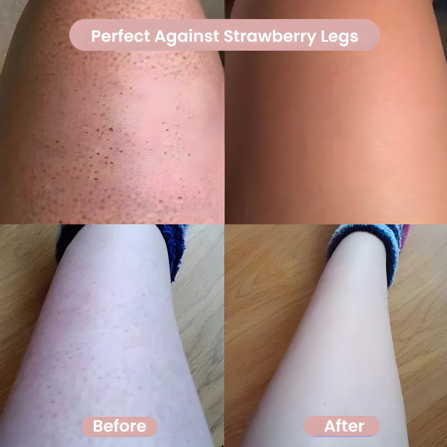 All-in-One Women’s Body Shaver™