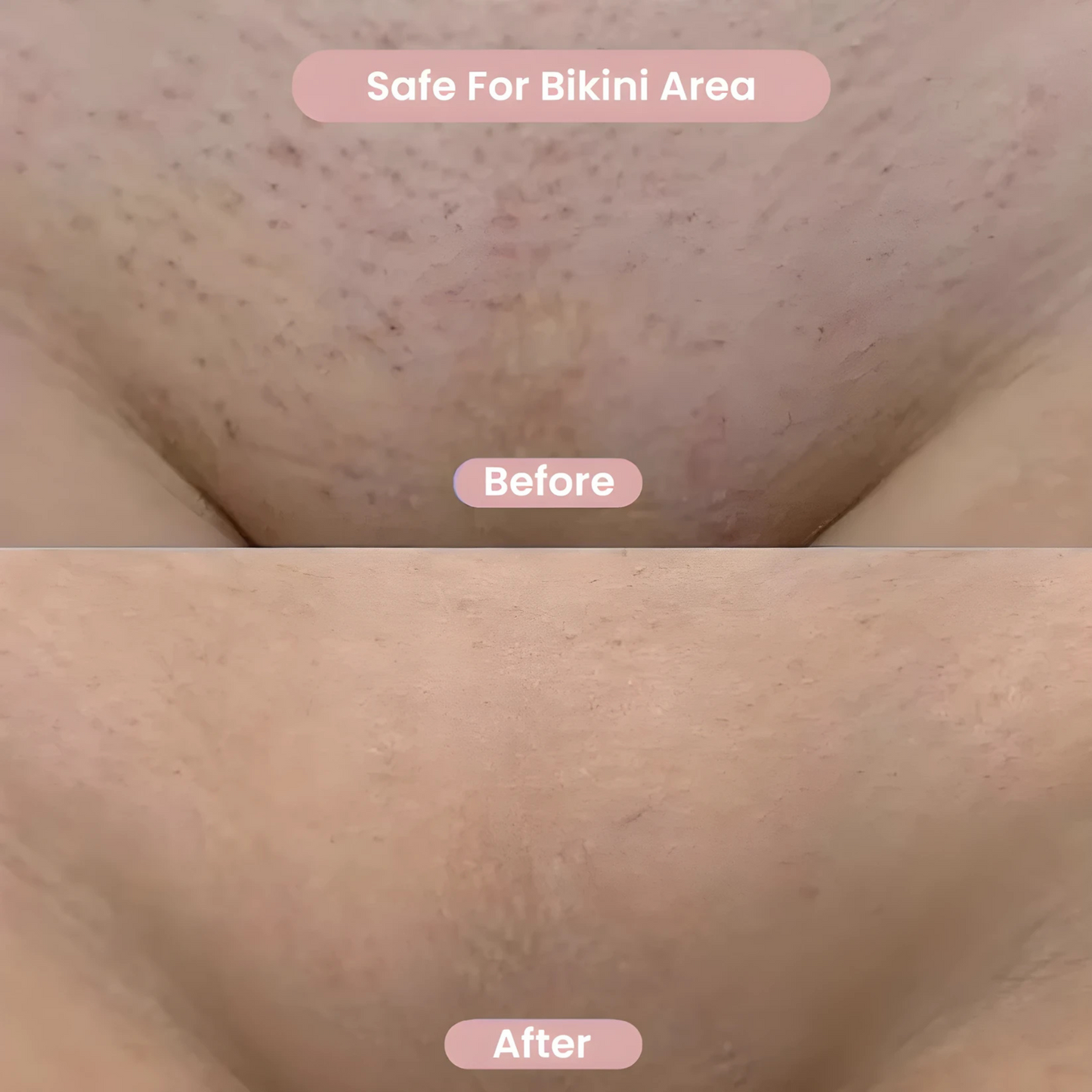 All-in-One Women’s Body Shaver™