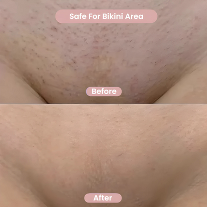 All-in-One Women’s Body Shaver™